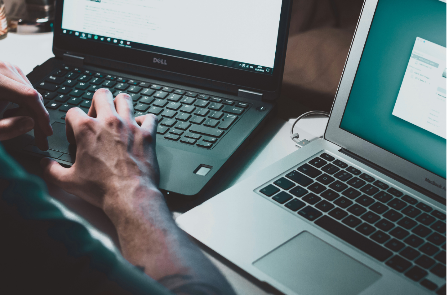 Hands typing on a Dell laptop next to an open MacBook with a blue-green screen, both on a desk.